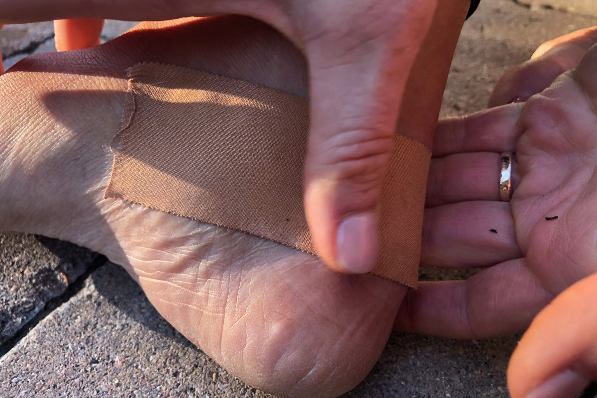 Using Leukotape to prevent a friction blister; (photo/Bergen Tjossem)